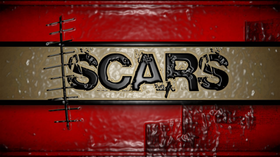 Scars